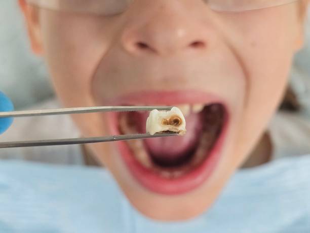 Best Emergency Treatment for Toothache in Huntland, TN